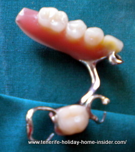 partial prothesis dental